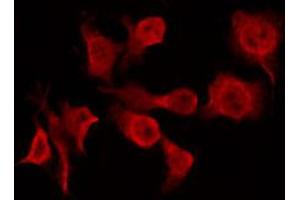 ABIN6266926 staining A549 by IF/ICC. (CERKL anticorps  (Internal Region))