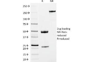 SDS-PAGE Analysis Purified IgM Mouse Monoclonal Antibody (IM373). (IGHM anticorps  (CF®488A))