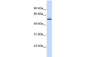 WB Suggested Anti-GTPBAntibody Titration:  0. (GTPBP10 anticorps  (Middle Region))