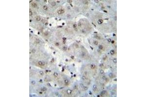 Immunohistochemistry analysis in formalin fixed and paraffin embedded human liver tissue reacted with H2AFZ Antibody (C-term) followed by peroxidase conjugation of the secondary antibody and DAB staining. (H2AFZ anticorps  (C-Term))