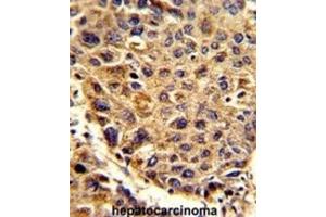 Immunohistochemistry (IHC) image for anti-Signal Peptidase Complex Subunit 3 Homolog (SPCS3) antibody (ABIN3002742)