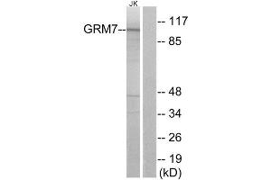 Western Blotting (WB) image for anti-Glutamate Receptor, Metabotropic 7 (GRM7) (Internal Region) antibody (ABIN1853052)