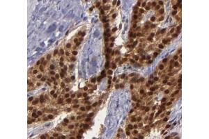 ABIN6268682 at 1/100 staining human breast tissues sections by IHC-P. (BAG1 anticorps  (N-Term))