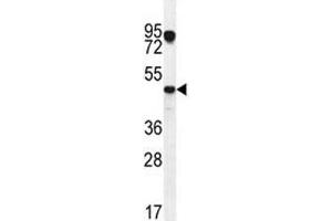 VEGFC antibody western blot analysis in MCF-7 lysate. (VEGFC anticorps  (AA 20-49))