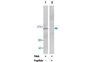 Western blot analysis of extracts from HeLa cells treated with PMA (125 ng/ml, 30 min), using PLCB3 polyclonal antibody . (PLCB3 anticorps  (Ser1105))