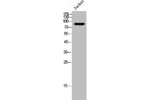 Western Blot analysis of Jurkat cells using Relaxin Receptor 2 Polyclonal Antibody (RXFP2 anticorps  (Internal Region))