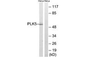 Western blot analysis of extracts from HeLa cells, using PLK5 Antibody. (PLK5 anticorps  (AA 131-180))