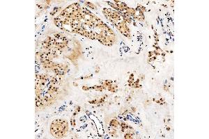IHC analysis of SMARCA2/BRM using anti-SMARCA2/BRM antibody (ABIN7601969).
