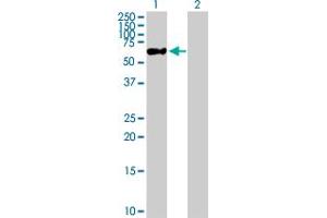Western Blot analysis of ZNF671 expression in transfected 293T cell line by ZNF671 MaxPab polyclonal antibody. (ZNF671 anticorps  (AA 1-556))