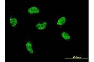 Immunofluorescence of monoclonal antibody to HOXA5 on HeLa cell. (HOXA5 anticorps  (AA 171-270))