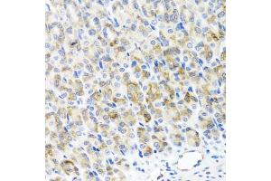 Immunohistochemistry of paraffin-embedded mouse stomach using RAD51C antibody (ABIN5974185) at dilution of 1/100 (40x lens). (RAD51C anticorps)
