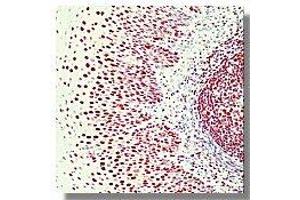 Image no. 1 for anti-X-Ray Repair Complementing Defective Repair in Chinese Hamster Cells 6 (XRCC6) antibody (ABIN187448) (XRCC6 anticorps)