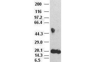 IL-6 antibody (3G9) at 1:500000 + recombinant human IL-6