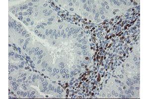 Image no. 1 for anti-GTPase, IMAP Family Member 4 (GIMAP4) antibody (ABIN1498460)