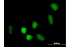 Immunofluorescence of purified MaxPab antibody to BCOR on HeLa cell. (BCOR anticorps  (AA 1-1004))