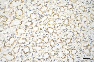 Immunohistochemistry was performed on paraffin-embedded mouse kidney using AGL antibody (ABIN7797592), 1:200).