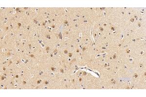 Detection of PIK3Cb in Human Cerebrum Tissue using Polyclonal Antibody to Phosphoinositide-3-Kinase Catalytic Beta Polypeptide (PIK3Cb)