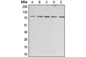 Western blot analysis of ABCG2 expression in HeLa (A), SP2/0 (B), H9C2 (C), HEK293T (D), HepG2 (E) whole cell lysates.