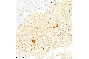 Immunohistochemistry of paraffin embedded rat spinal cord using FGF11 (ABIN7073941) at dilution of 1:2200 (400x lens) (FGF11 anticorps)