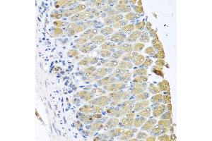 Immunohistochemistry of paraffin-embedded mouse stomach using OGFR antibody (ABIN6128395, ABIN6145006, ABIN6145007 and ABIN6222871) at dilution of 1:100 (40x lens).