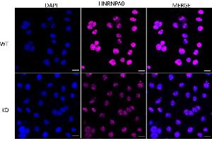 anti-Heterogeneous Nuclear Ribonucleoprotein A0 (HNRNPA0) antibody
