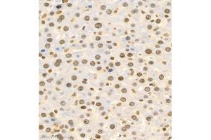 Immunohistochemistry of paraffin embedded rat liver using BPTF (ABIN7073234) at dilution of 1:500 (400x lens)