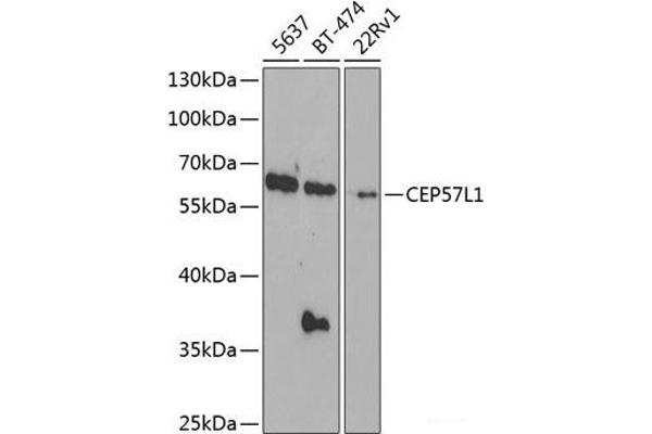 CEP57L1 抗体