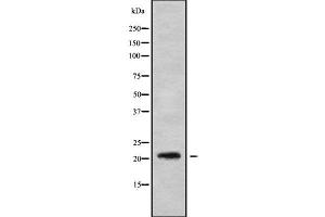 Western blot analysis of MED22 using NIH-3T3 whole cell lysates (MED22 anticorps  (Internal Region))