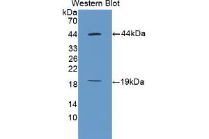 Western blot analysis of the recombinant protein. (Ki-67 anticorps  (AA 2386-2674))