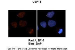 Sample Type :  Human brain stem cells (NT2)   Primary Antibody Dilution :   1:500  Secondary Antibody :  Goat anti-rabbit Alexa Fluor 594  Secondary Antibody Dilution :   1:1000  Color/Signal Descriptions :  Red: USBlue: DAPI  Gene Name :  US Submitted by :  Dr. (USP16 anticorps  (N-Term))
