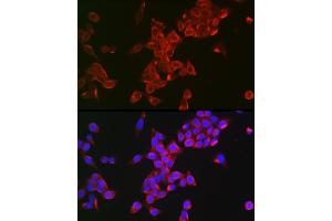 Immunofluorescence analysis of HeLa using FSHR Rabbit pAb (ABIN3022001, ABIN3022002, ABIN3022003, ABIN1512927 and ABIN6218564) at dilution of 1:100 (40x lens).