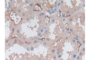 Detection of SELP in Human Kidney Tissue using Polyclonal Antibody to P-Selectin (SELP)