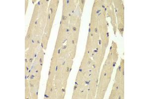 Immunohistochemistry of paraffin-embedded mouse heart using USP7 antibody (ABIN6293331) at dilution of 1:200 (40x lens). (USP7 anticorps)
