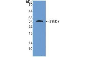 Detection of Recombinant GSTa4, Rat using Polyclonal Antibody to Glutathione S Transferase A4 (GSTA4) (GSTA4 anticorps  (AA 2-222))
