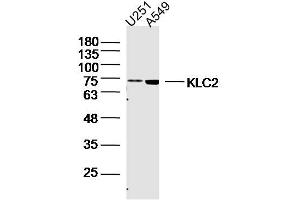 Lane 1: U251 lysates Lane 2: A549 lysates probed with KLC2 Polyclonal Antibody, Unconjugated  at 1:300 dilution and 4˚C overnight incubation.