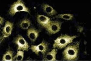 Immunofluorescent staining of RSV-3T3 cells.