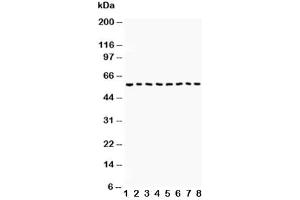 Western blot testing of Beclin 1 antibody and Lane 1:  COLO320