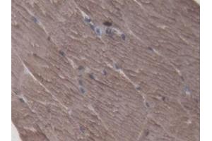 Detection of CKM in Porcine Skeletal muscle Tissue using Polyclonal Antibody to Creatine Kinase, Muscle (CKM)