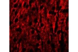 anti-Rab Interacting Lysosomal Protein-Like 1 (RILPL1) (N-Term) antibody