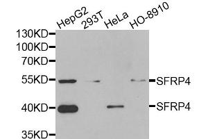 Western blot analysis of extracts of various cell lines, using SFRP4 antibody (ABIN5973810) at 1/1000 dilution. (SFRP4 anticorps)