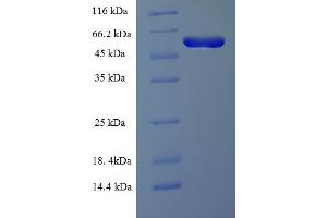 SDS-PAGE (SDS) image for Required For Meiotic Nuclear Division 5 Homolog A (RMND5A) (AA 1-385), (full length) protein (His-SUMO Tag) (ABIN5711859)