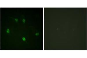 Immunofluorescence analysis of HeLa cells, using Cyclin E1 (Ab-77) Antibody. (Cyclin E1 anticorps  (AA 43-92))