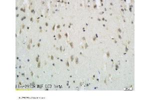 Formalin-fixed and paraffin embedded rat brain tissue labeled with Anti-LC3B/MAP LC3β/MAP1A Polyclonal Antibody, Unconjugated  followed by conjugation to the secondary antibody and DAB staining (MAP1LC3A/B anticorps  (AA 21-121))