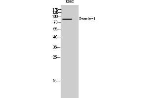 Western Blot analysis of K562 cells using Stonin-1 Polyclonal Antibody.