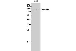 Western Blot analysis of K562 cells using Stonin-1 Polyclonal Antibody. (STON1 anticorps  (AA 660-740))