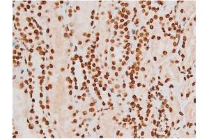 ABIN6267604 at 1/200 staining Human kidney tissue sections by IHC-P.