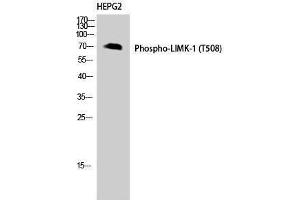 Western Blotting (WB) image for anti-LIM Domain Kinase 1 (LIMK1) (pThr508) antibody (ABIN3172924) (LIM Domain Kinase 1 anticorps  (pThr508))