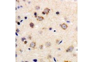 Immunohistochemical analysis of Beta-1 Adrenergic Receptor staining in human brain formalin fixed paraffin embedded tissue section. (ADRB1 anticorps)