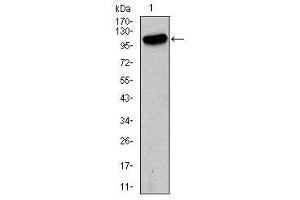 Image no. 2 for anti-Glutamate Receptor, Ionotropic, AMPA 2 (GRIA2) antibody (ABIN1491627)