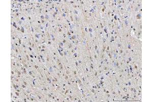 IHC analysis of RGS12 using anti-RGS12 antibody (ABIN7602410). (RGS12 anticorps  (AA 746-995))